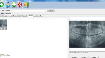 DENTIA Patient Images are becoming a more important part of modern dentistry; intra oral and extra oral images can be captured and saved directly to the patient’s clinical record. user our advance tool for editing X-RAYS images. and a lot more.